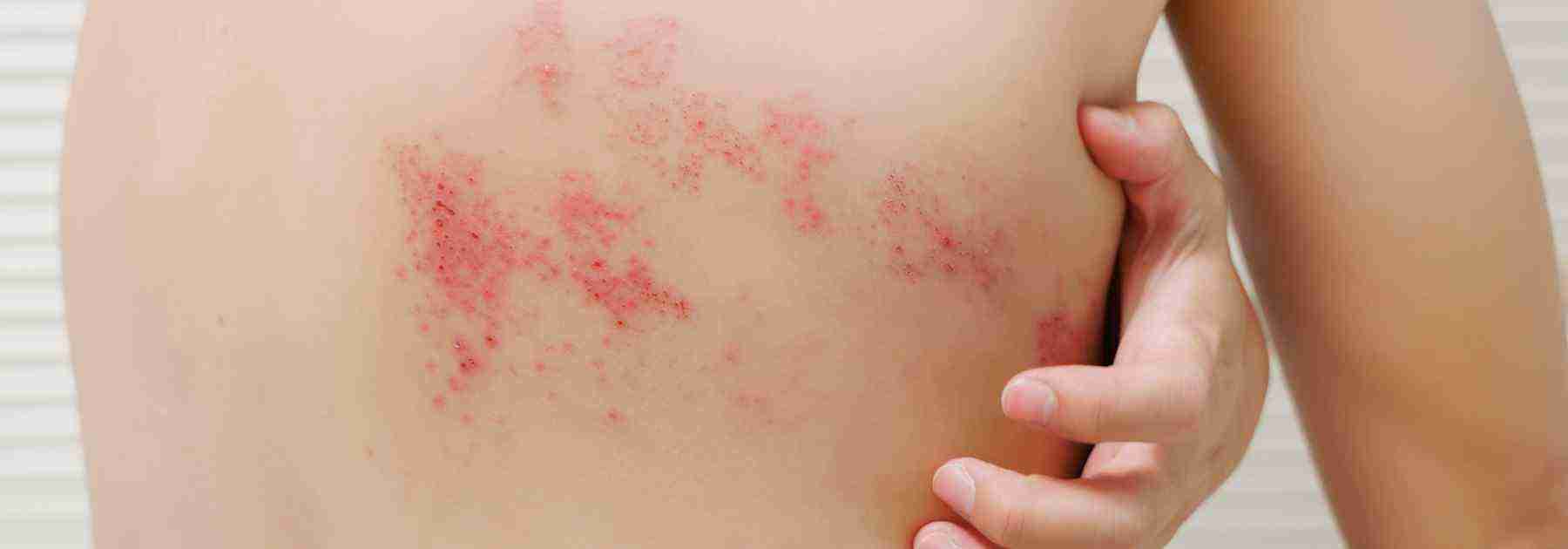winter vaccines