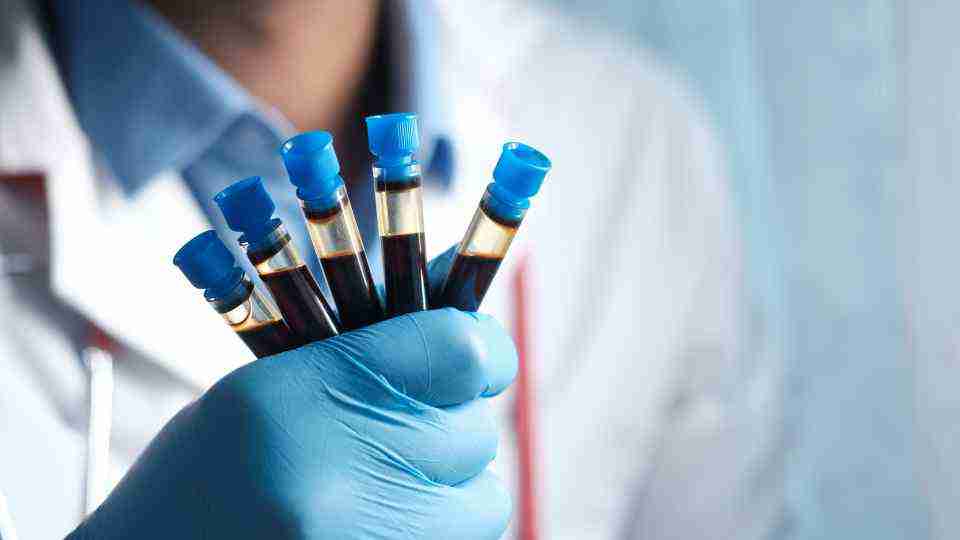 Where to book private blood tests near me
