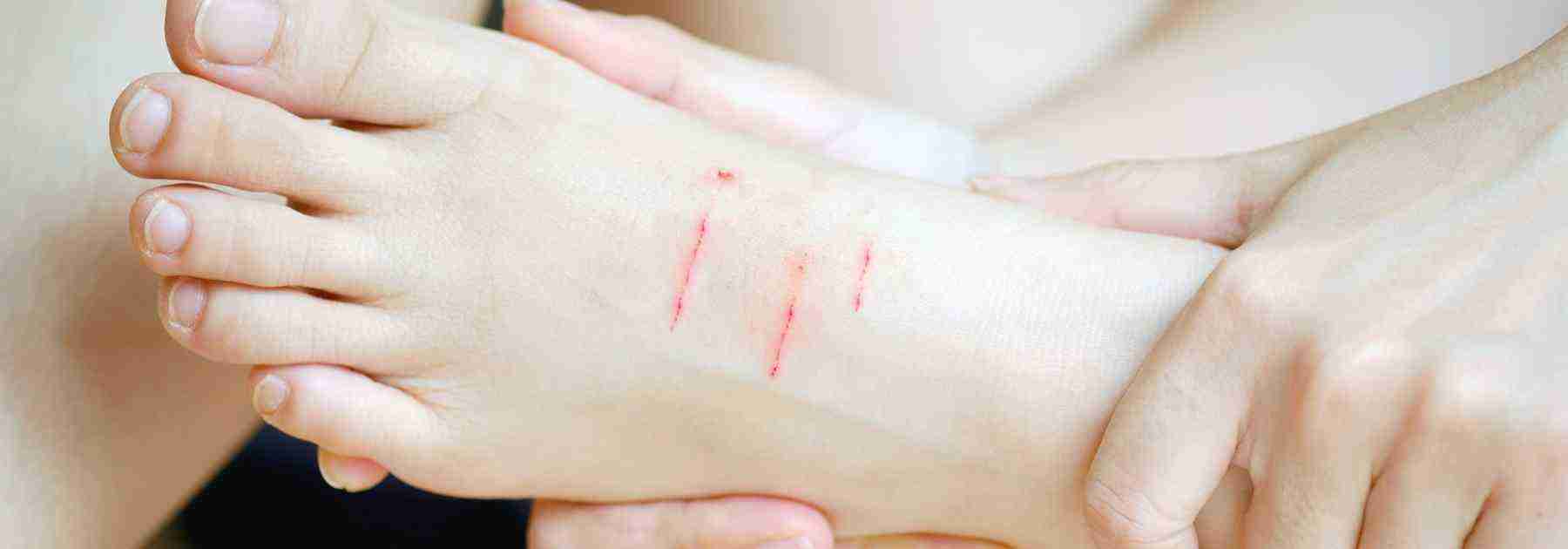 How long does a tetanus booster last following injury? 